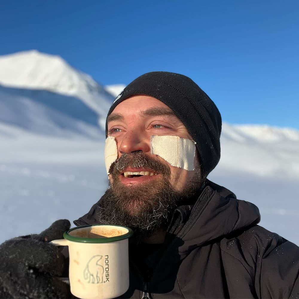Rasmus Kragh med tape på kinderne og et krus kaffe under en arktisk ekspedition